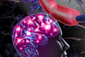 A first-of-its-kind human study suggests mental well-being may start in the gut