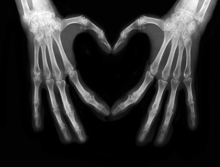 Abyss Ingredients' marine collagen demonstrates joint benefits
