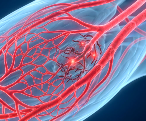 Advancing the science of dietary nitrate with integrated vascular assessment