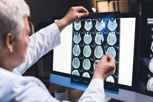 Aker BioMarine joins Norwegian Research Centre to prevent neurodegenerative diseases
