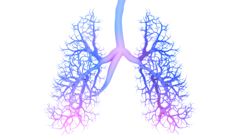 Fucoidan may exhibit anti-tumour effects in lung cancer