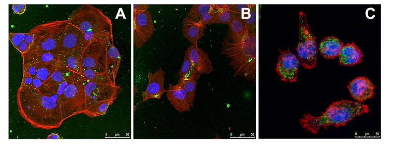 Figure 3: The uptake of particles in (A) Caco2, (B) HepG2 and (C) J774A.1 macrophages cells observed using confocal microscopy; green dots = particles, blue = nuclei, red = actin filaments