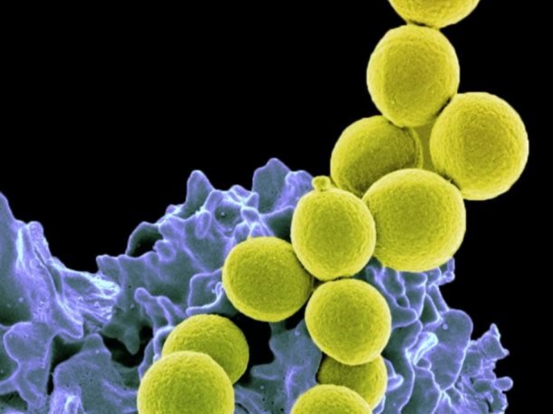 Probiotic reduces S. Aureus colonisation in phase 2 trial