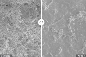 Biohm Health chooses AIDP to distribute new probiotic biofilm killer