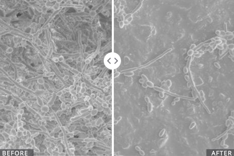 Biohm Health chooses AIDP to distribute new probiotic biofilm killer