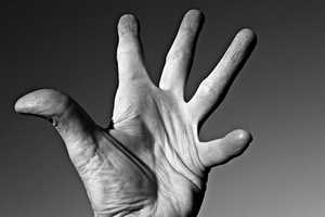 Bioiberica obtains authorisation to sell Mobilee in Australia and New Zealand
