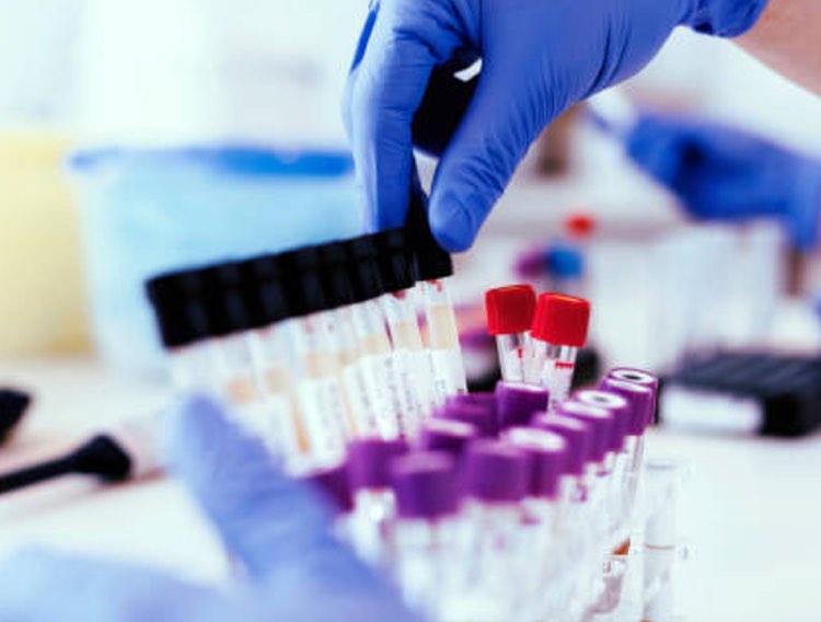 Biotin debacle: AACC provides guidance to prevent patient harm