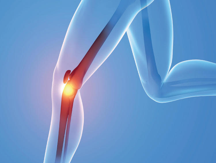Boots to offer TSI osteoarthritis tablets OTC