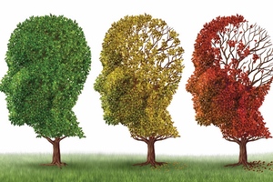 Can L-ergothioneine transform the healthy ageing segment?
