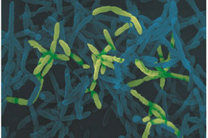 Christensenella: The cornerstone of the gut microbiota?