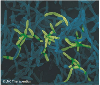 Christensenella: The cornerstone of the gut microbiota?