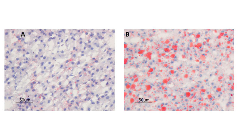 Combating childhood obesity by preventing “fatty liver” in foetus