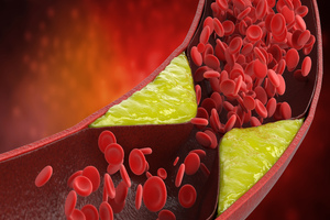 Disproquima launches vitamin K2 for heart and bone health