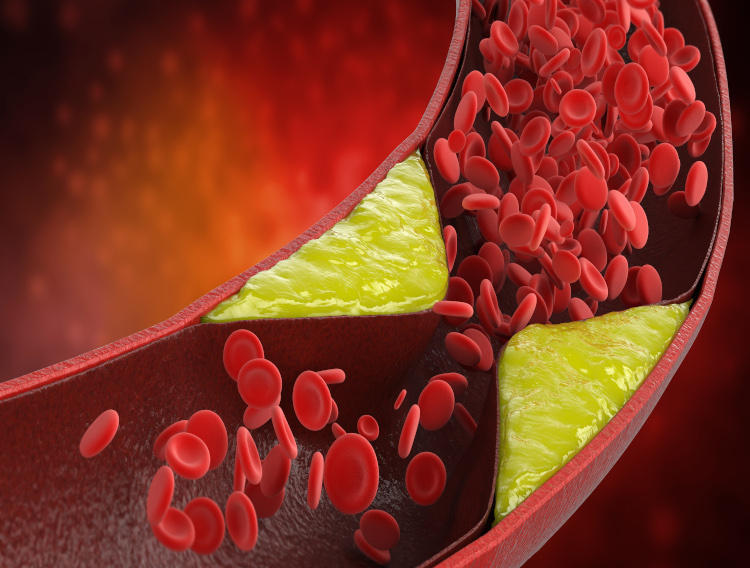 Disproquima launches vitamin K2 for heart and bone health