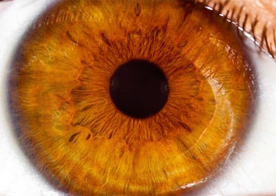 Dry eye syndrome risk increases with low vitamin D levels