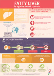 DSM joins Dr Arun Sanyal on vitamin E and fatty liver webinar