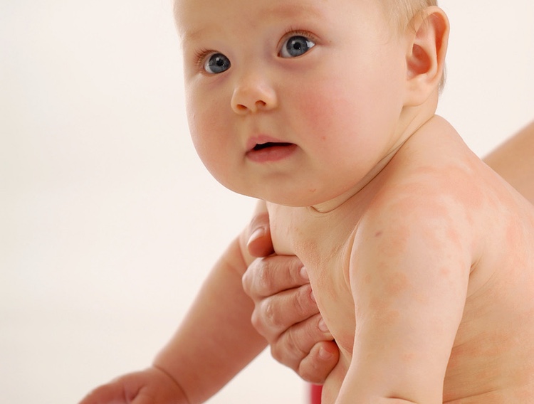 DuPont announces $7m infant health collaboration with APC Microbiome