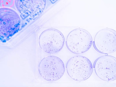 DuPont provides probiotics and expertise for sepsis research