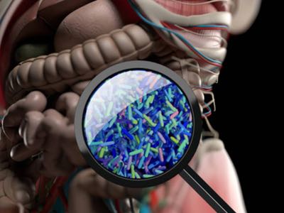 DuPont: Study shows benefits of high dose multi-strain probiotics