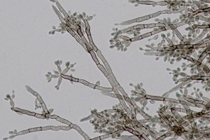 Exeter fungal research centre earns five-year funding boost