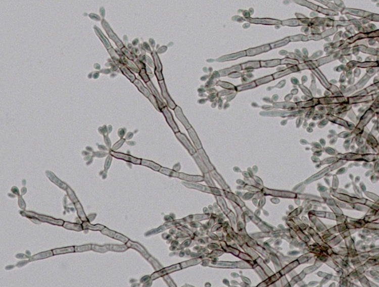 Exeter fungal research centre earns five-year funding boost