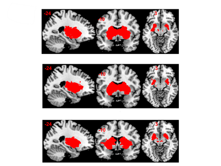 Fructose produces less rewarding sensations in the brain