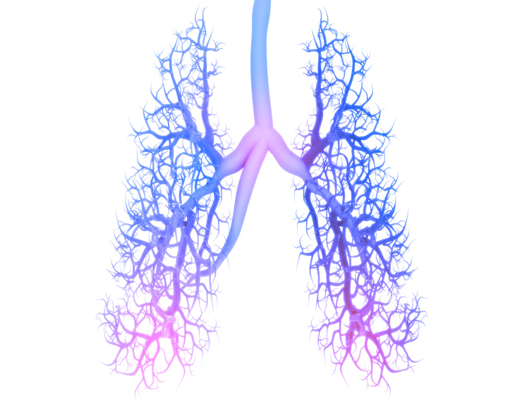 Fucoidan may exhibit anti-tumour effects in lung cancer