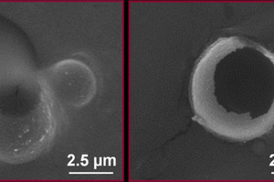 Gates Foundation funds work on edible microballoons to improve nutrition for mothers and children in developing countries
