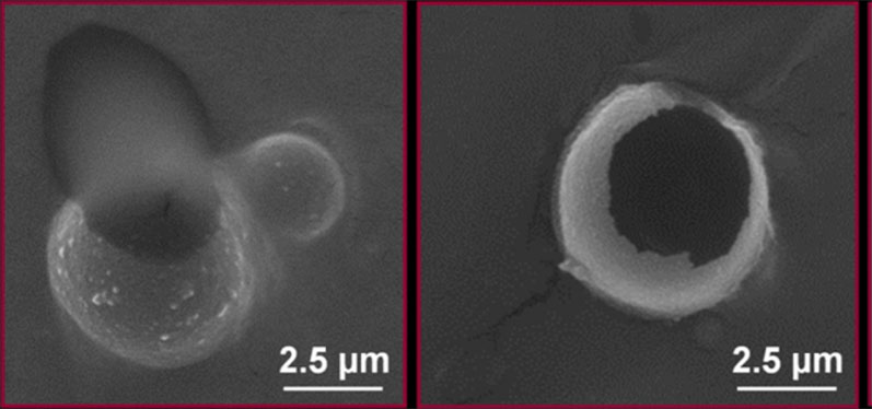 Gates Foundation funds work on edible microballoons to improve nutrition for mothers and children in developing countries

