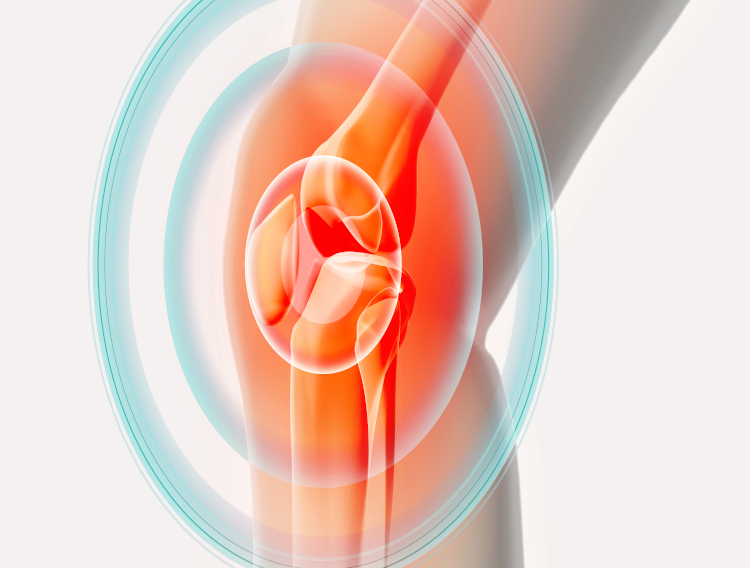 Gencor PEA shown to alleviate joint discomfort