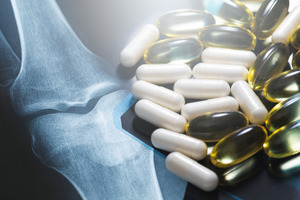 Glucosamine linked to 25% faster Alzheimer's progression in major new study