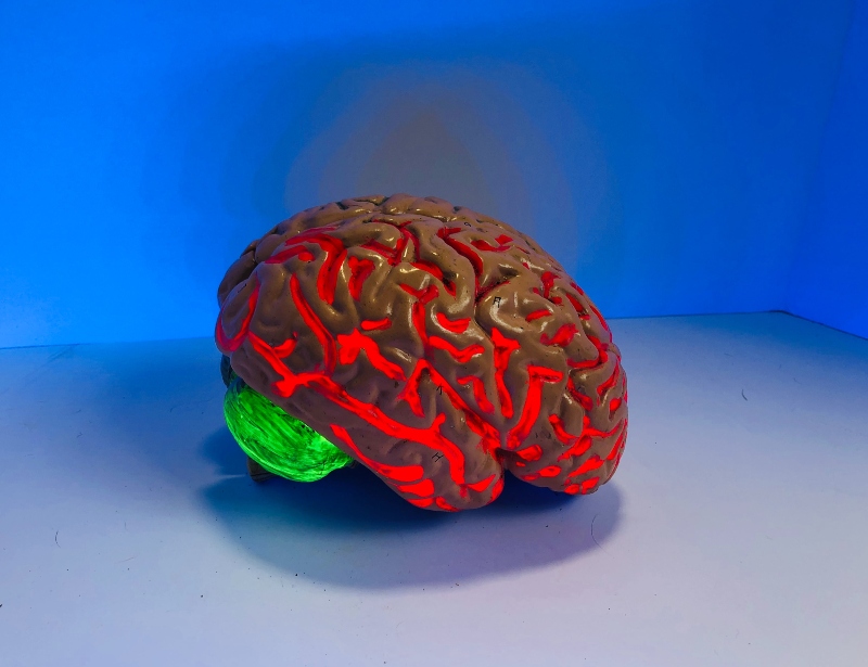 Gnosis announces production line expansion for cognitive health