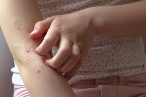 GOED provides insights into EPA and DHA omega-3s and skin health through two new reports