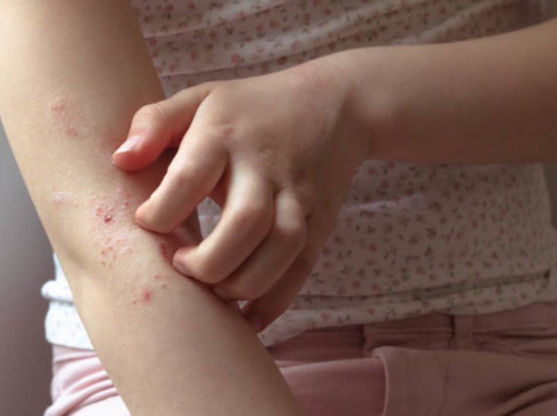 GOED provides insights into EPA and DHA omega-3s and skin health through two new reports