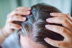 HairAge Vitae improves hair pigmentation and reduces grey hair density