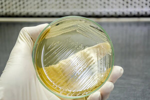 Health Canada recognises Saccharomyces cerevisiae as a source of resveratrol and yeast beta-glucan