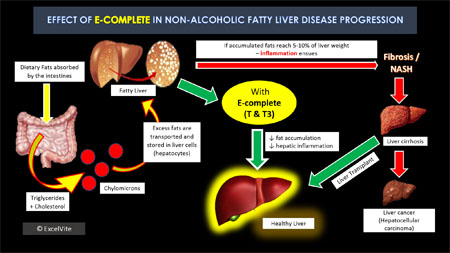 Hepatoprotective effects of tocopherols and tocotrienols in fatty liver disease