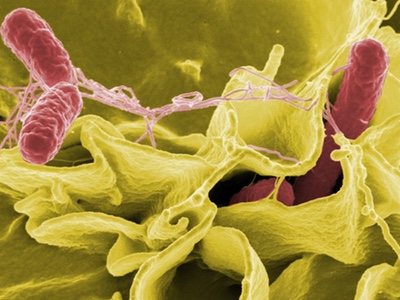 Imprecise iron supplementation can increase Salmonella