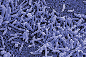 International probiotics powerhouse, Probiotical, steps up its US presence 
