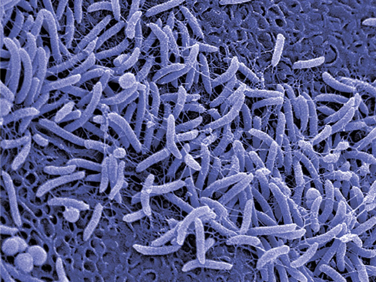 International probiotics powerhouse, Probiotical, steps up its US presence 
