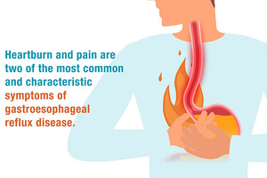 Keep GERD symptoms at bay with RefluG Isorepair