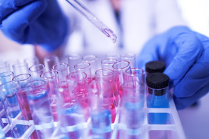 Measuring the mood in the laboratory sector: materials bottlenecks and staff shortages