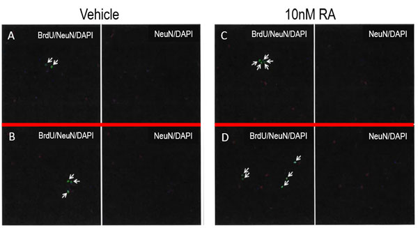 Neumentix enhances new nerve cell growth in rat hippocampal cells