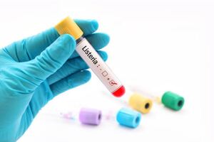 New method uses electric shocks to kill bacteria 