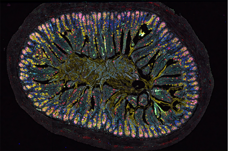 New research links the "gut brain" with allergies
