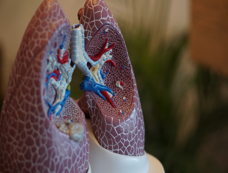 Palm fruit complex may ameliorate lung injury