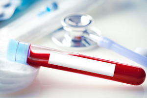 PharmaLinea completes iron syrup clinical trial