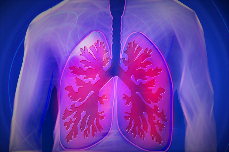 PLT’s new clinical study on AlvioLife demonstrates enhanced respiratory support, immune support and aerobic capacity 
