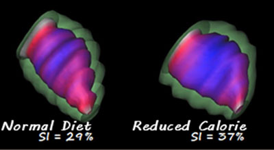 Poor nutrition during pregnancy can cause early ageing of baby's heart