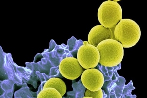 Probiotic reduces S. Aureus colonisation in phase 2 trial